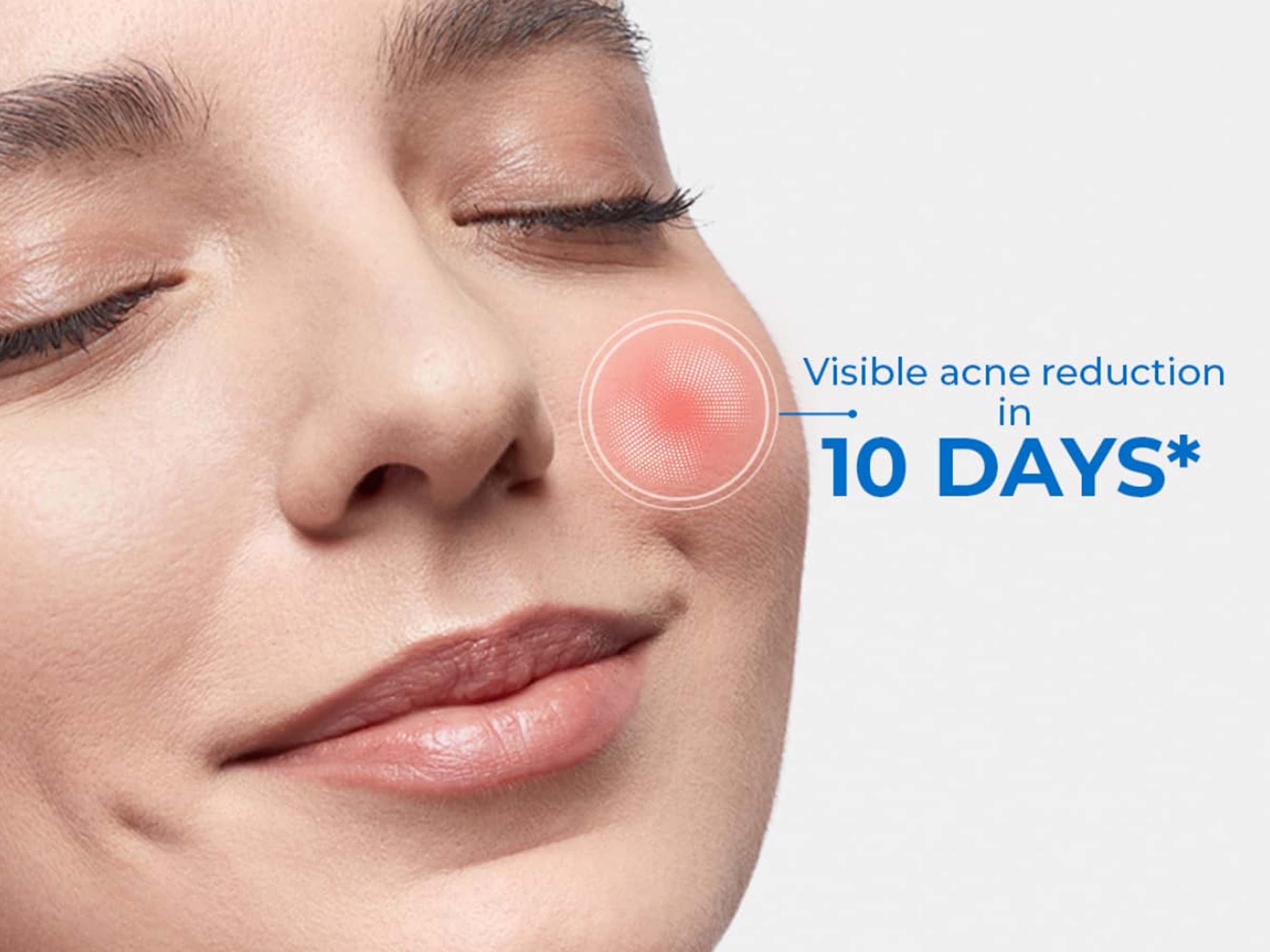 D'Acne Foaming Face Wash